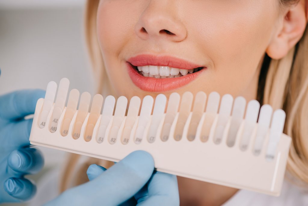 cropped view of male dentist matching teeth color of woman with palette in clinic, teeth whitening
