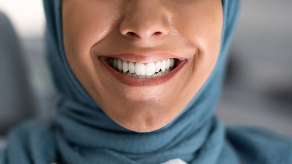 Teeth Whitening. Young Muslim Lady Smiling With Her Healthy White Teeth, Closeup